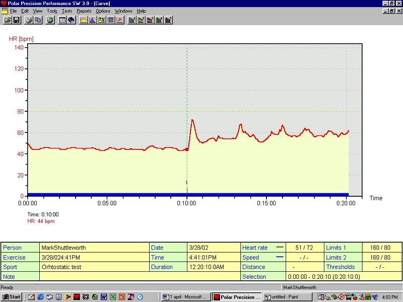 Orthostatic heart-rate graph