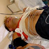 Orthostatic Testing